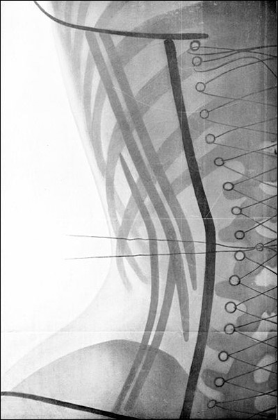 Fashion Corsetsbustier on Coilhouse    Blog Archive    Corset X Rays From 1908